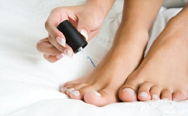 Medicinal nail fungus lacquer